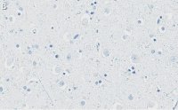 Anti-APP Antibody, clone 1F22 ZooMAb® Rabbit Monoclonal