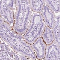 Anti-AQP10 antibody produced in rabbit 