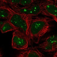 Anti-ARAF antibody produced in rabbit HPA046188-100UL