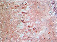 Anti-Arc (N-terminal) antibody produced in rabbit SAB4200461-200UL