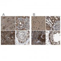 Anti-ARFGAP2 antibody produced in rabbit HPA018152-100UL