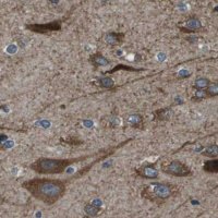 Anti-ARFGAP2 antibody produced in rabbit HPA018152-100UL