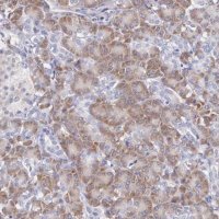 Anti-ARFGAP3 antibody produced in rabbit HPA000638-100UL