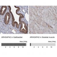 Anti-ARHGAP42 antibody produced in rabbit 