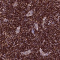 Anti-ARHGEF18 antibody produced in rabbit