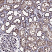 Anti-ARHGEF28 antibody produced in rabbit 