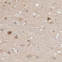 Anti-ARHGEF7 antibody produced in rabbit 