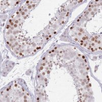 Anti-ARID3B antibody produced in rabbit 
