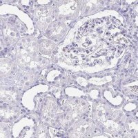 ANTI-ARPP21 antibody produced in rabbit
