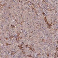 Anti-ARRDC1 antibody produced in rabbit HPA044345-100UL