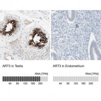 Anti-ART3 antibody produced in rabbit 