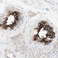 Anti-ART3 antibody produced in rabbit