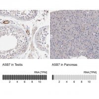 Anti-ASB7 antibody produced in rabbit 