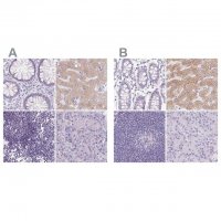 Anti-ASGR2 antibody produced in rabbit
