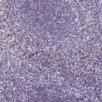 Anti-ASH2L antibody produced in rabbit 