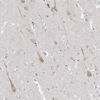 Anti-ASNS antibody produced in rabbit 