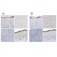 Anti-ASPRV1 antibody produced in rabbit