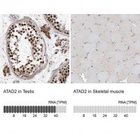 Anti-ATAD2 antibody produced in rabbit 