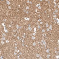 Anti-ATCAY antibody produced in rabbit 