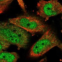 Anti-ATF5 antibody produced in rabbit 