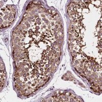 Anti-ATG16L1 antibody produced in rabbit