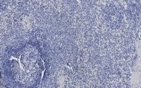 Anti-ATG9A Antibody, clone 5B11, ZooMAb� Rabbit Monoclonal 