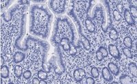 Anti-ATM Antibody, clone 4N19, ZooMAb� Rabbit Monoclonal 