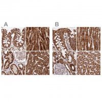 Anti-ATP5A1 antibody produced in rabbit HPA040622-100UL
