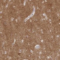 Anti-ATP6V1F antibody produced in rabbit 