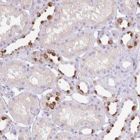 Anti-ATP6V1G3 antibody produced in rabbit 
