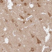 Anti-ATP8A1 antibody produced in rabbit 