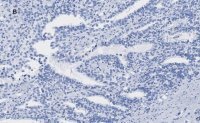 Anti-ATRX Antibody, clone 2A12, ZooMAb� Rabbit Monoclonal 