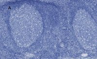 Anti-Aurora B Antibody, clone 7C4, ZooMAb� Rabbit Monoclonal 