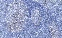 Anti-Aurora B Antibody, clone 7C4, ZooMAb� Rabbit Monoclonal 