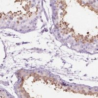 Anti-AXDND1 antibody produced in rabbit 