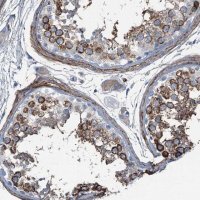 Anti-AXL antibody produced in rabbit 