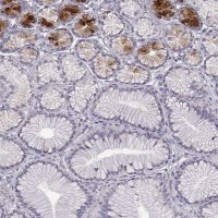 Anti-B3GNT6 antibody produced in rabbit 