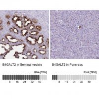 Anti-B4GALT2 antibody produced in rabbit 