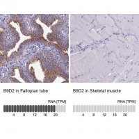 Anti-B9D2 antibody produced in rabbit 