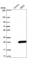 Anti-B9D2 antibody produced in rabbit 