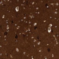 Anti-BAIAP2 antibody produced in rabbit 