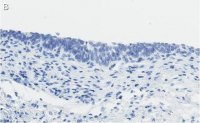 Anti-Bak Antibody, clone 2D18 ZooMAb� Rabbit Monoclonal 