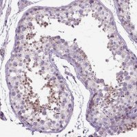 Anti-BANF2 antibody produced in rabbit 