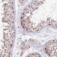 Anti-BARD1 antibody produced in rabbit 