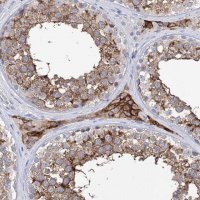 Anti-BBS4 antibody produced in rabbit 