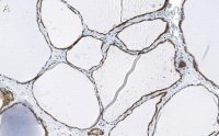 Anti-Bcl-2 Antibody, clone 1K8 ZooMAb� Rabbit Monoclonal 