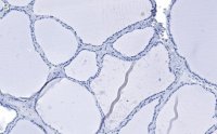 Anti-Bcl-2 Antibody, clone 1K8 ZooMAb® Rabbit Monoclonal
