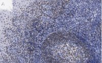 Anti-Bcl11A Antibody, clone 2C4 ZooMAb� Rabbit Monoclonal 