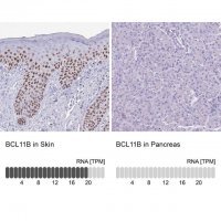 Anti-BCL11B antibody produced in rabbit 