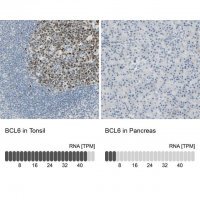 Anti-BCL6 antibody produced in rabbit 